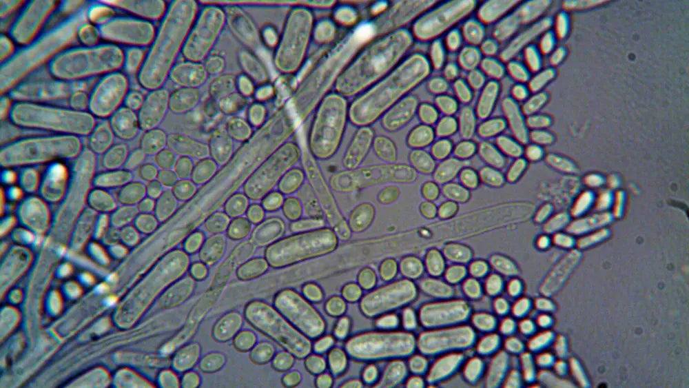 Probiotic yeast and bacterial probiotic formula symbols arranged for comparison in New Zealand