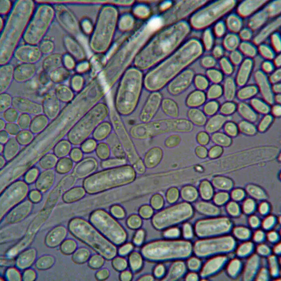 Probiotic yeast and bacterial probiotic formula symbols arranged for comparison in New Zealand